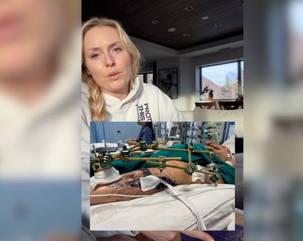 Bewegendes Vonn-Statement