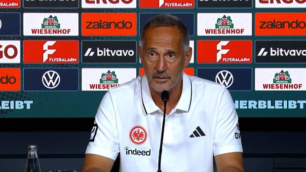 "Nicht akzeptabel!" Hütter mahnt seine Spieler ab