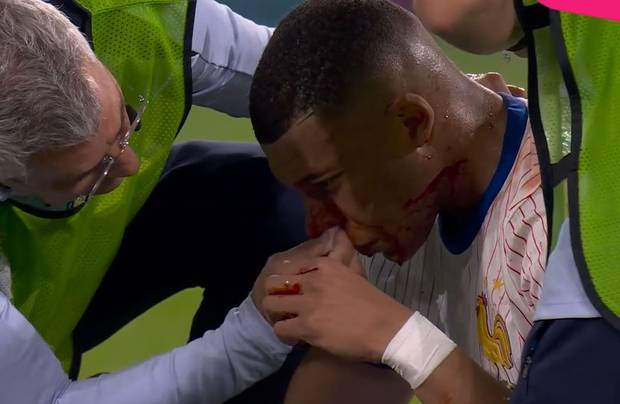 „Ein Unding“: Kritik an Mbappé