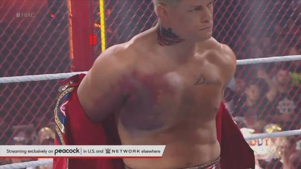 WWE-Horrorverletzung: Cody spricht