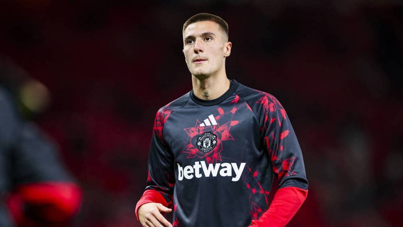 Neue Hiobsbotschaft für Manchester United