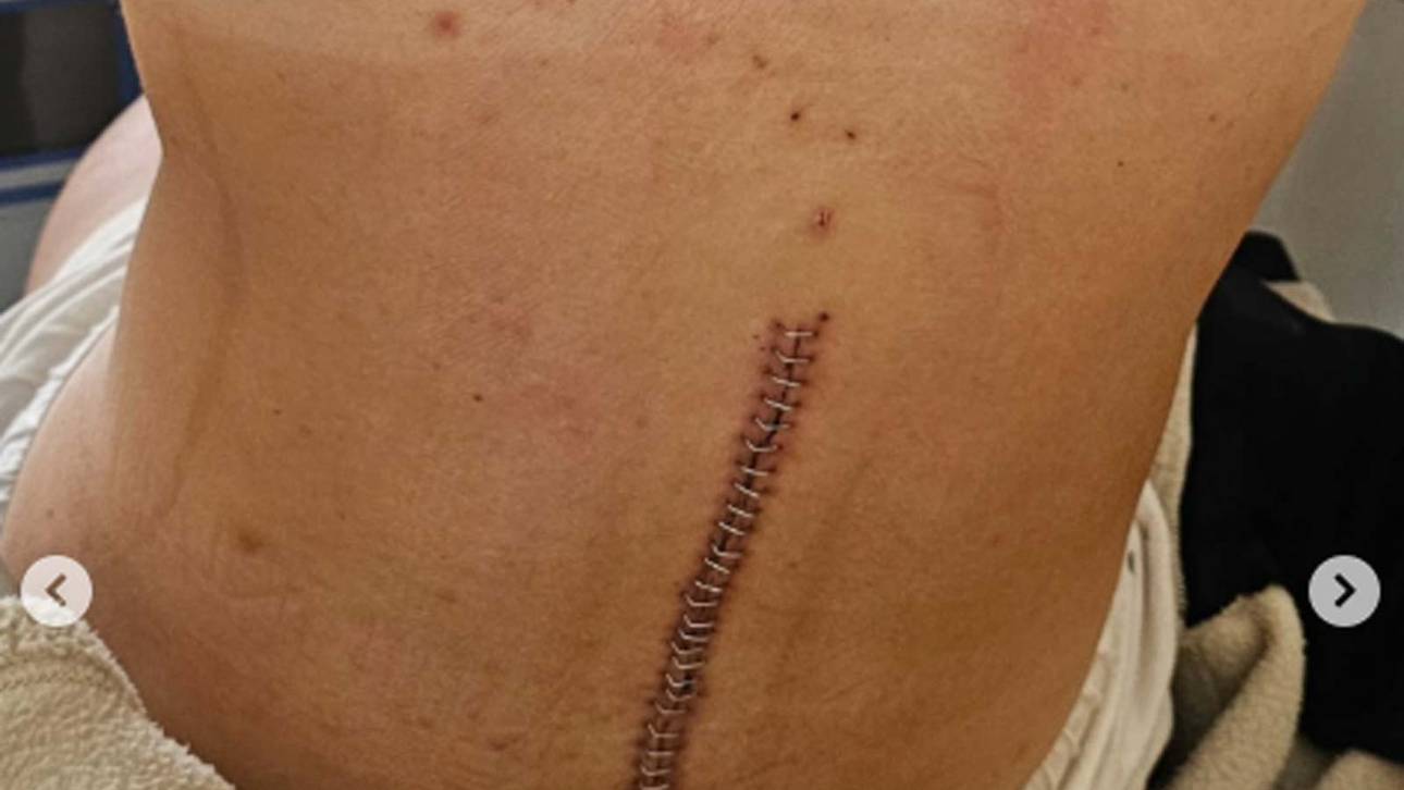 Flora Dolci verbreitete Bilder ihrer Verletzung