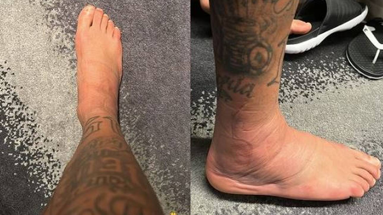 Neymar fällt mindestens für das kommende Spiel aus