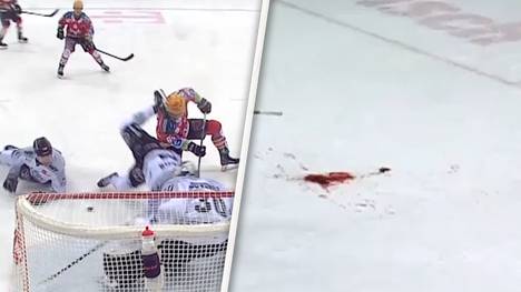 Schockmoment um Bremerhavens Christian Wejse, der unglücklich mit dem Schlittschuh seines Gegners am Hals getroffen wird.