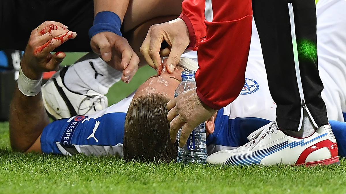 Er wird länger behandelt, ...