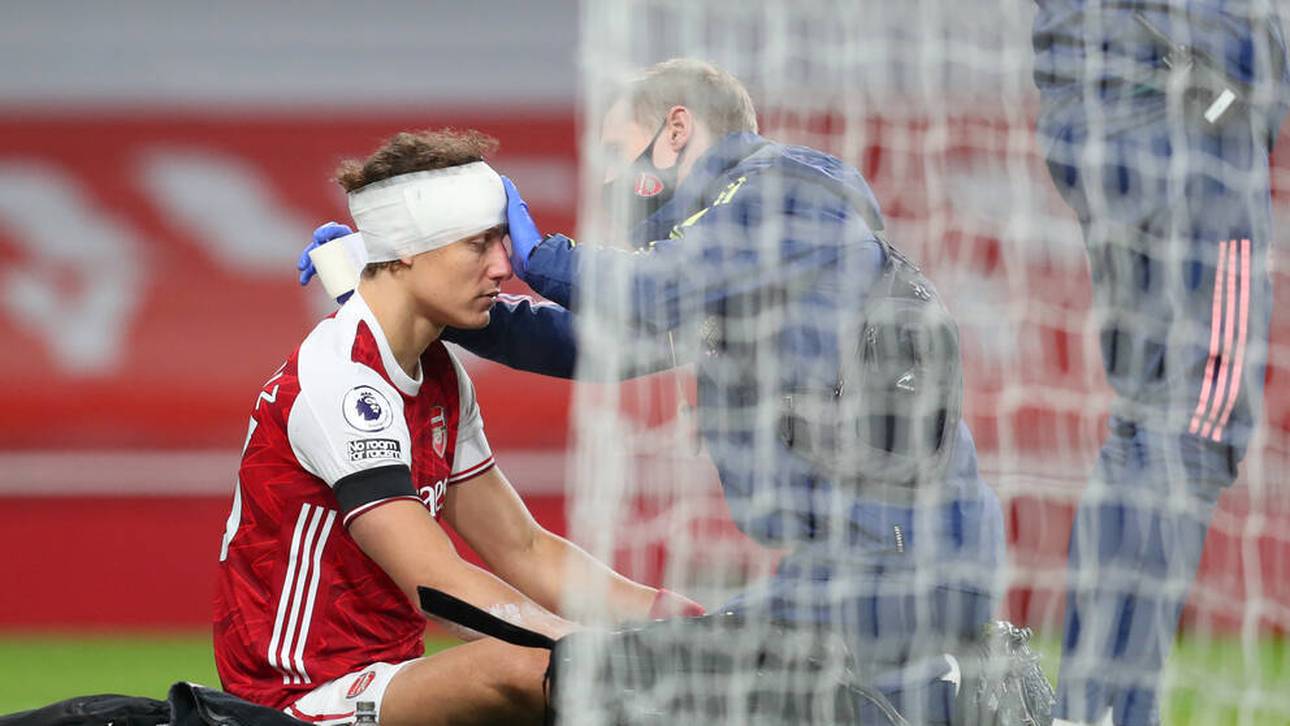 England testet Wechsel-Revolution