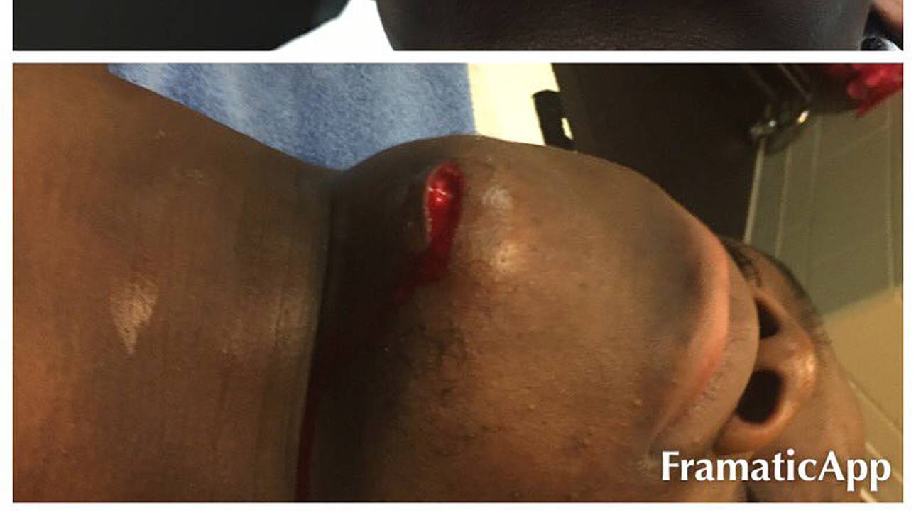 Schröder postet Schock-Foto