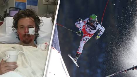 Ondrej Bank verliert bei der Super-Kombination einen Ski und stürzt schwer