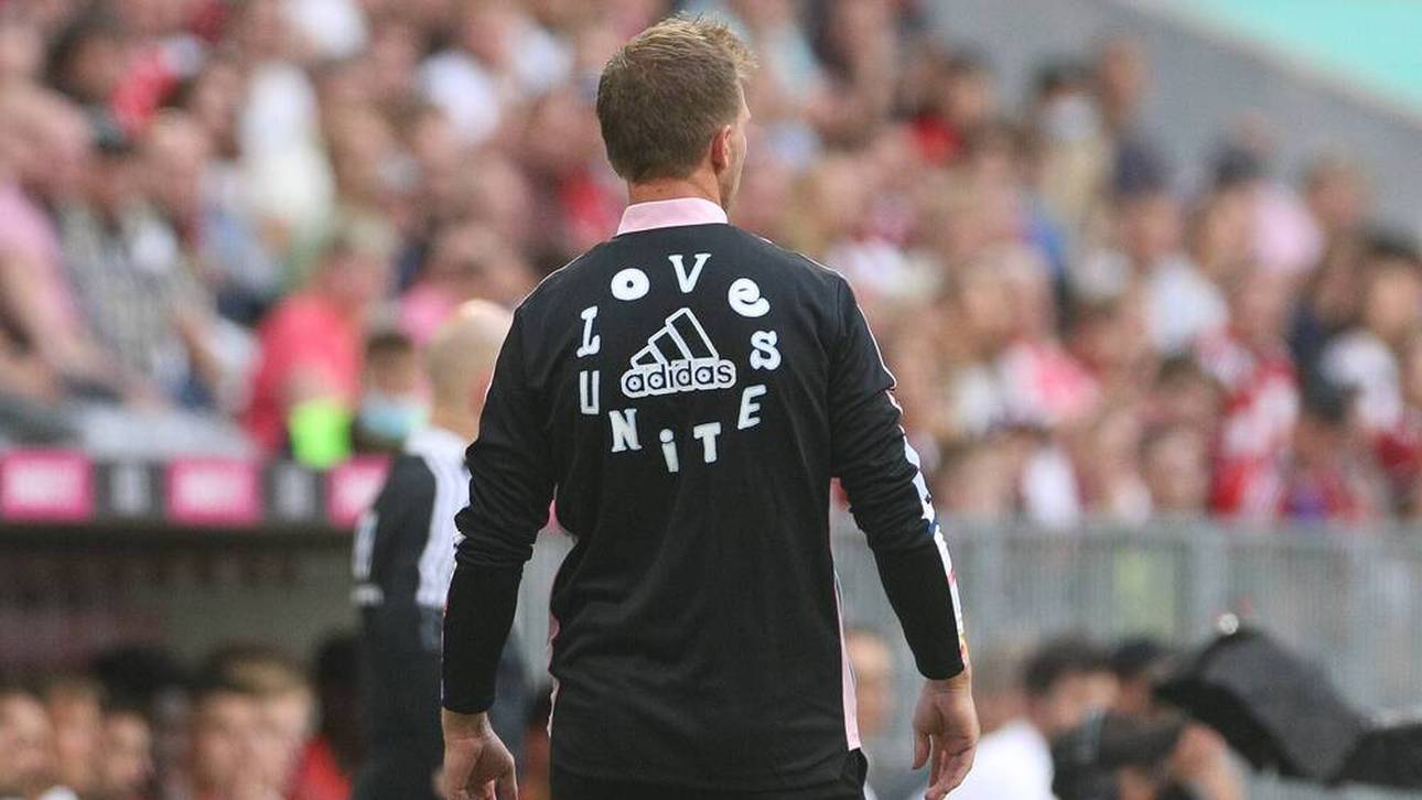 Nagelsmann fällt mit Outfit auf