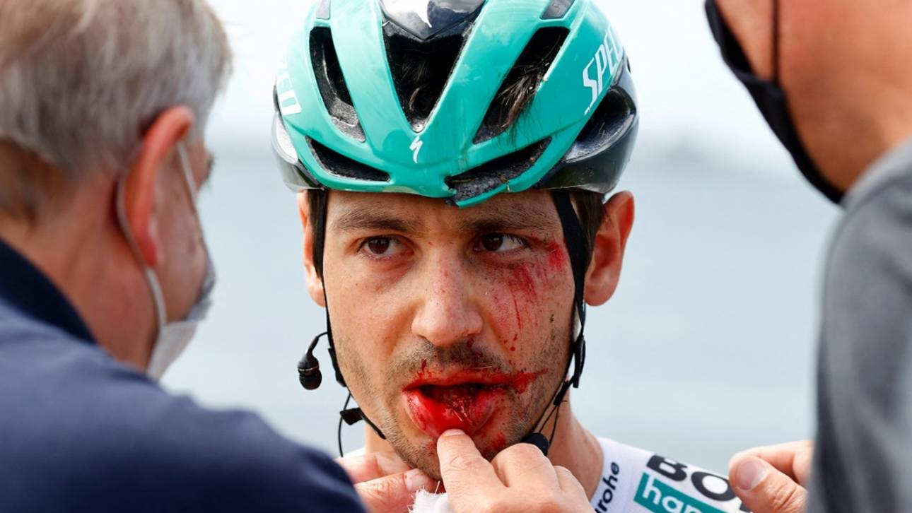 So geht es Buchmann nach dem Sturz