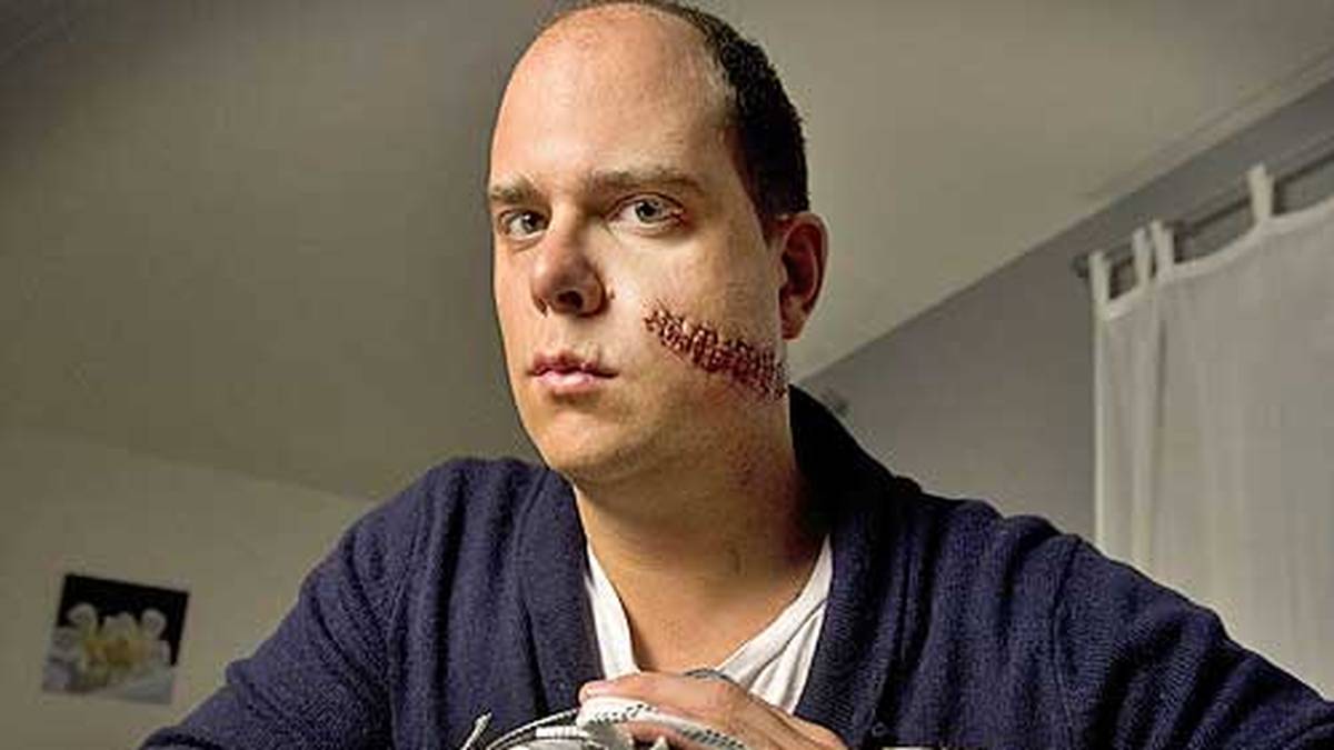 Dort wird er genäht. Vier Stunden dauert die Operation. Allerdings hat er Probleme, sein Gesicht zu bewegen, da ein Nerv in Mitleidenschaft gezogen wurde. "Mir geht es den Umständen entsprechend gut", schreibt Courcelles auf seiner Facebook-Seite