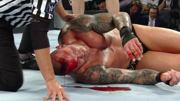 Randy Orton wurde im Hauptkampf des WWE SummerSlam von Brock Lesnar blutig geprügelt
