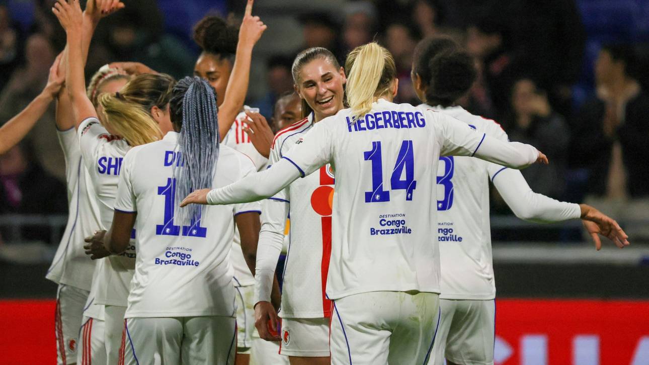 DFB-Frauen vor Topstar gewarnt