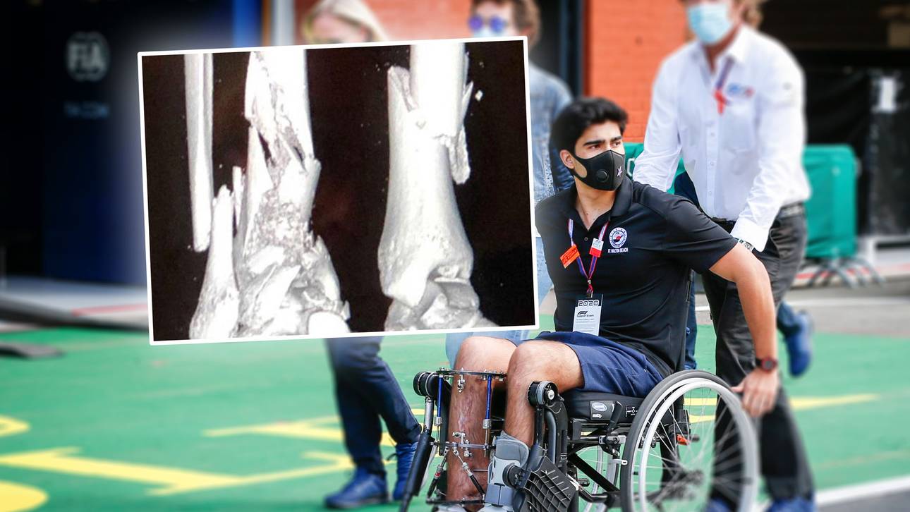 Correa zeigt Röntgenbilder