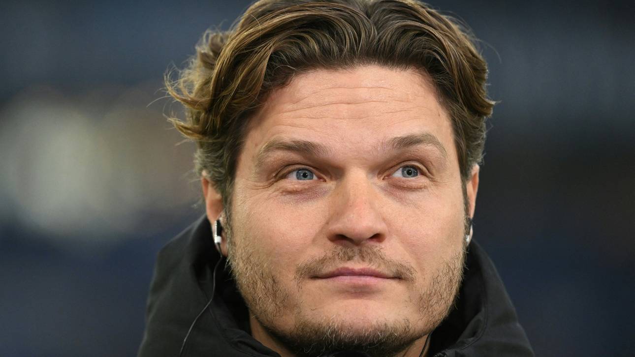 BVB-Coach Terzic: „Kein Grund, negativ“ zu sein