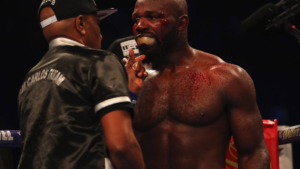 Der Franzose Carlos Takam geht als Herausforderer in den Kampf und bezieht eine ordentliche Tracht Prügel