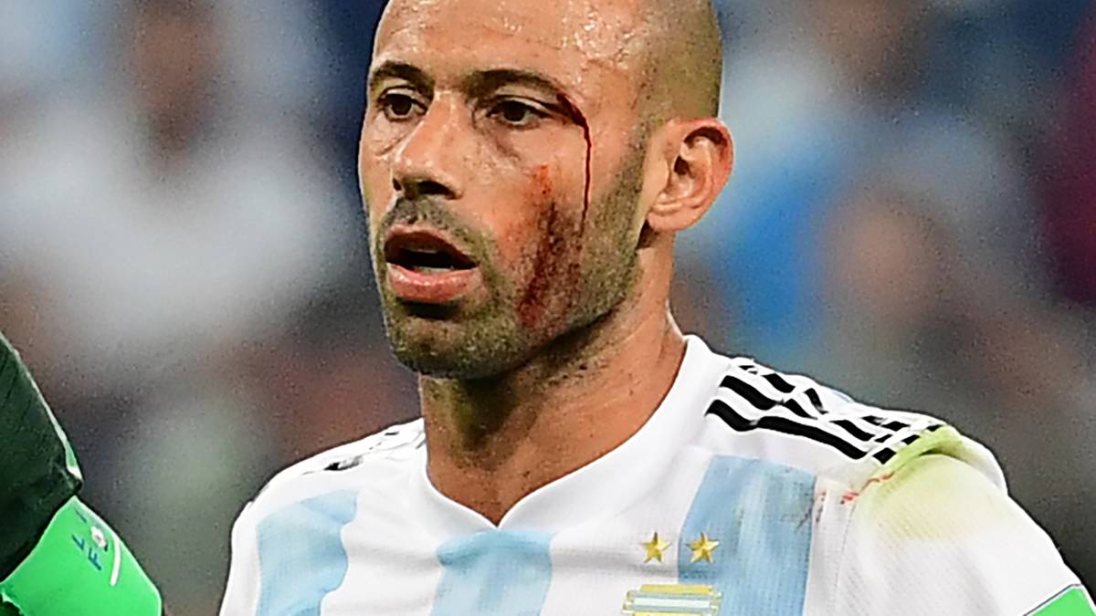 Mascherano hält für Argentinien regelmäßig die Knochen hin, wie zuletzt gegen Nigeria. Hatte allerdings allein in diesem Spiel mehrere Totalausfälle, die fast zu Gegentoren führten. Konstanz schlägt hier Kampf, Punkt für Frankreich. 7:4