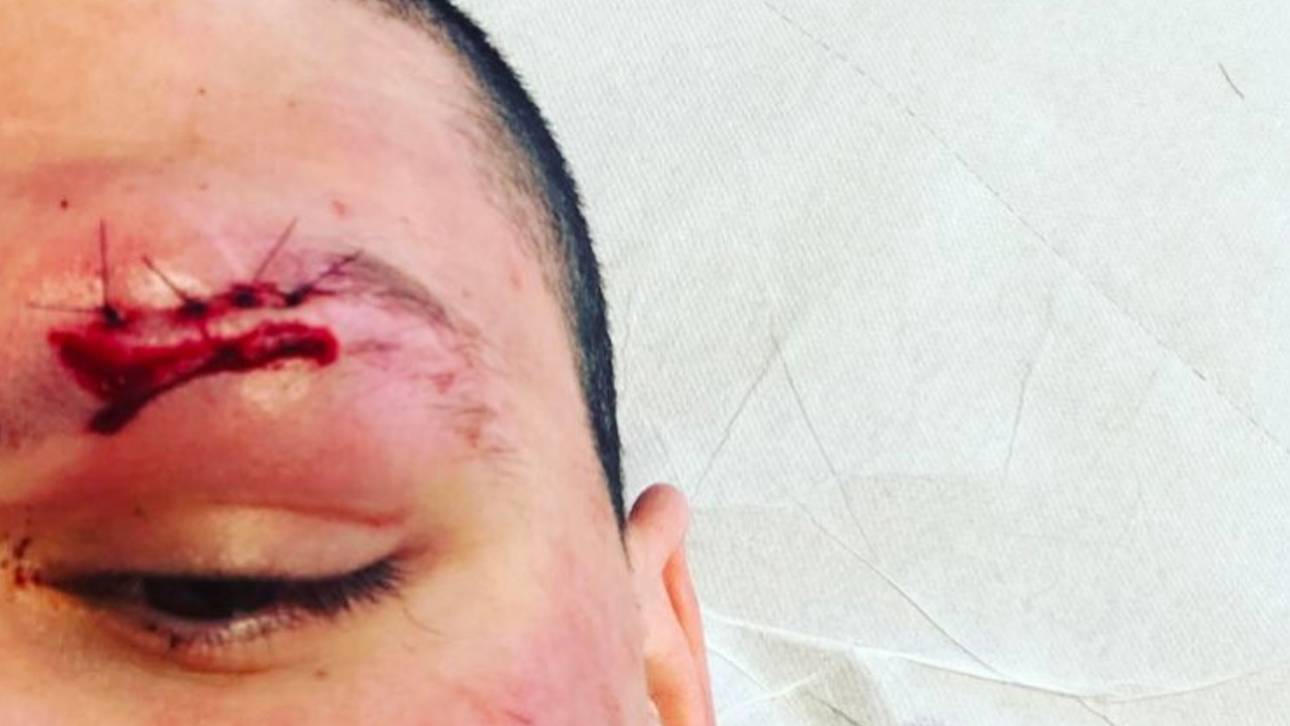 Blut-Crash im HSV-Training