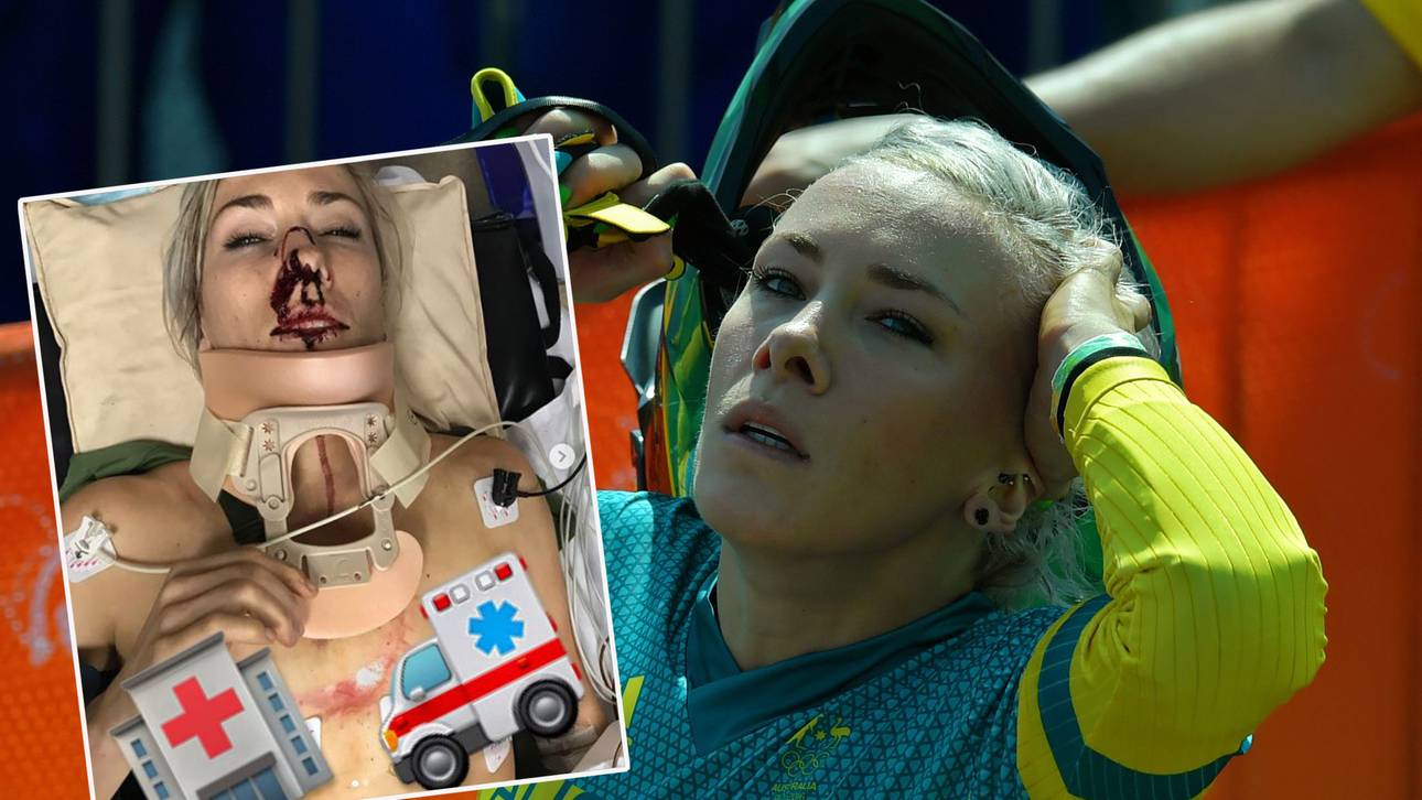 BMX-Weltmeisterin mit Horror-Unfall