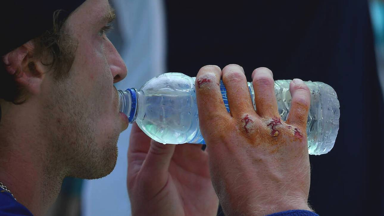 Russe verletzt sich bei Ausraster selbst