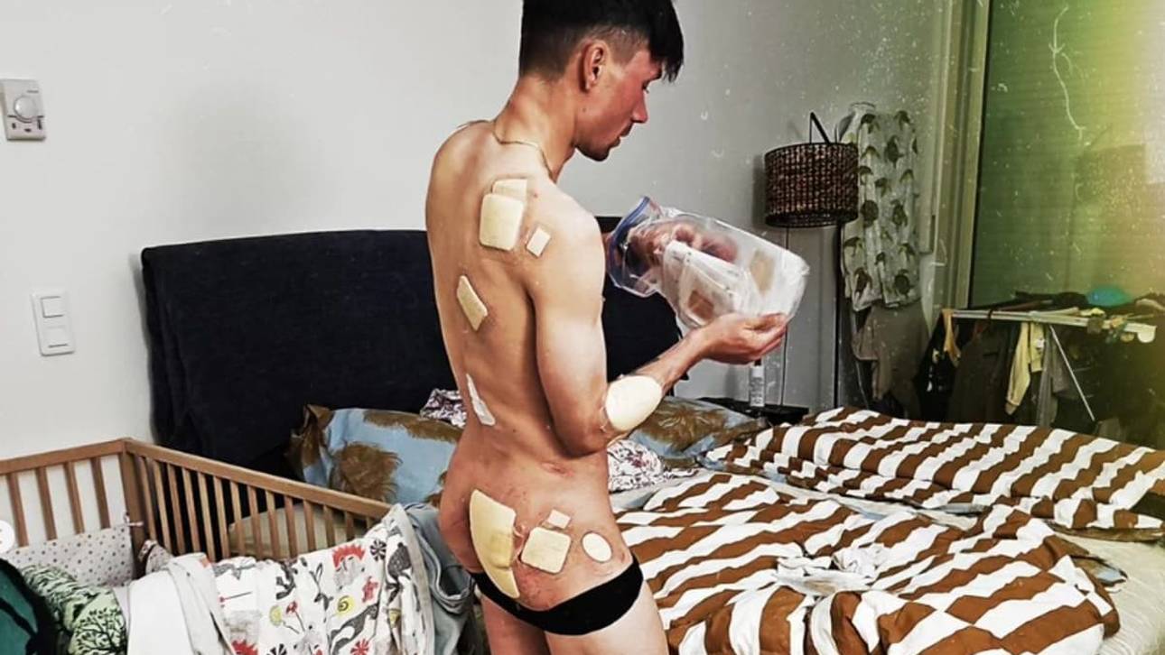 Schock-Fotos von Rad-Superstar