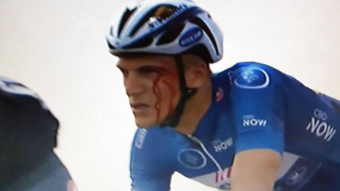 Spuck-Vorwurf nach Eklat um Kittel