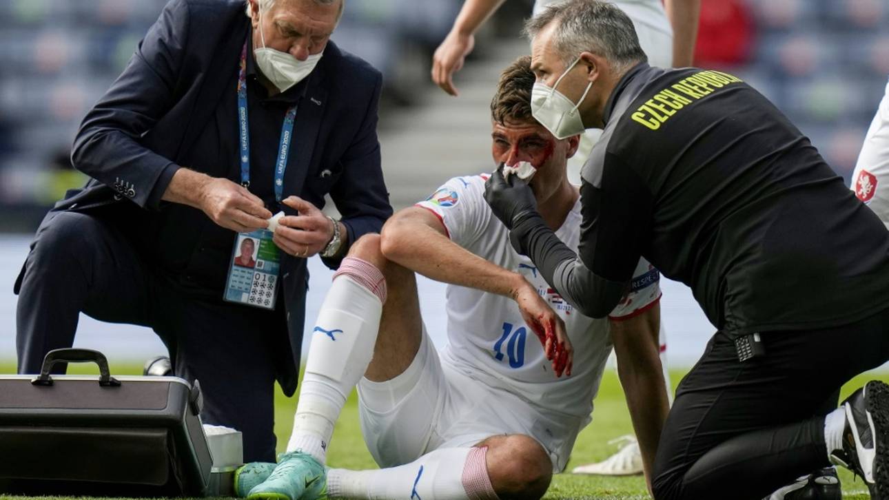 So steht es um Schicks Nase