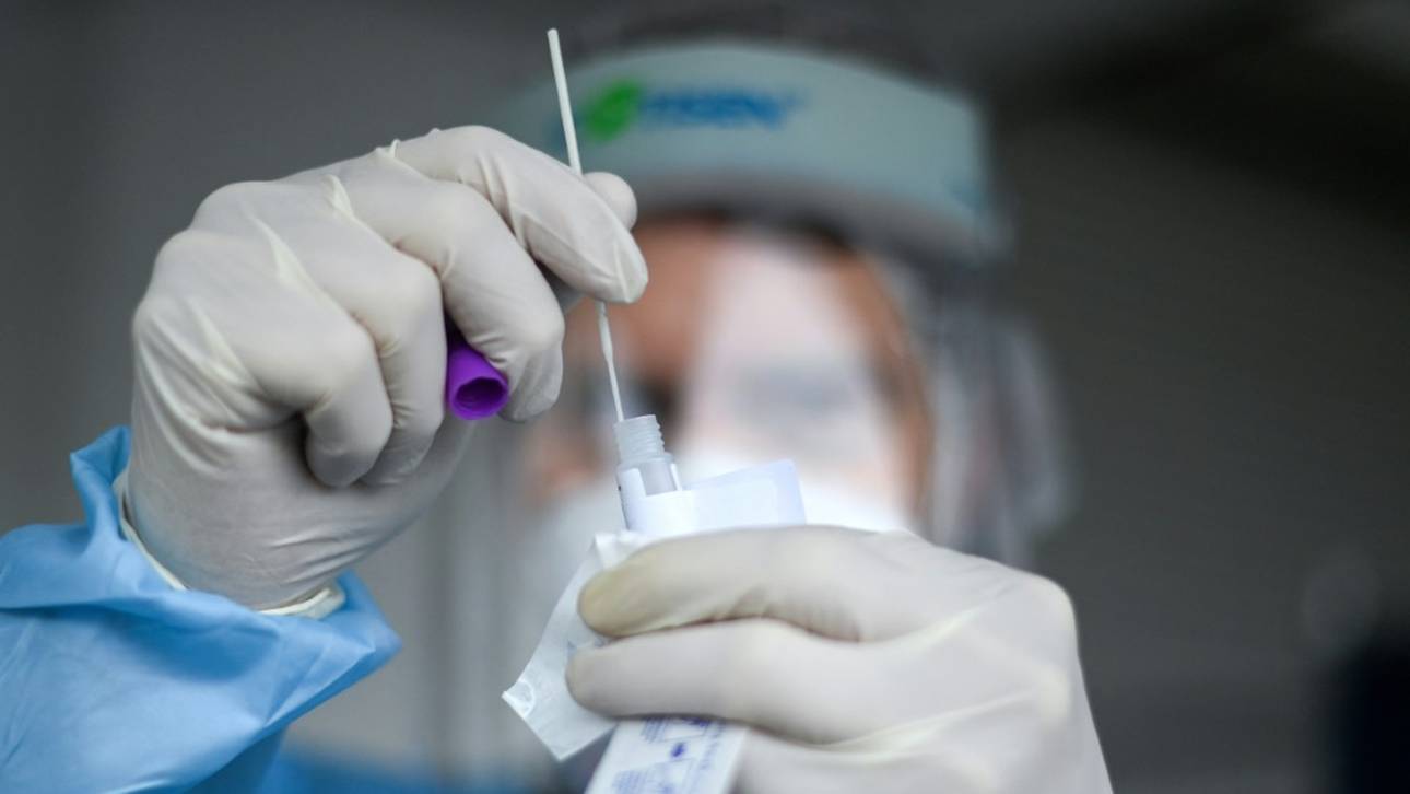 Olympia in Tokio: Tägliche Tests für alle Sportler