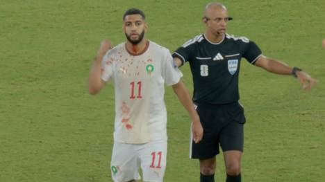 Bayern-Flirt Ismael Saibari blutet im WM-Spiel von Marokko gegen die Niederlande heftig am Kopf. Der Angreifer muss sein blutbeflecktes Trikot wechseln. 