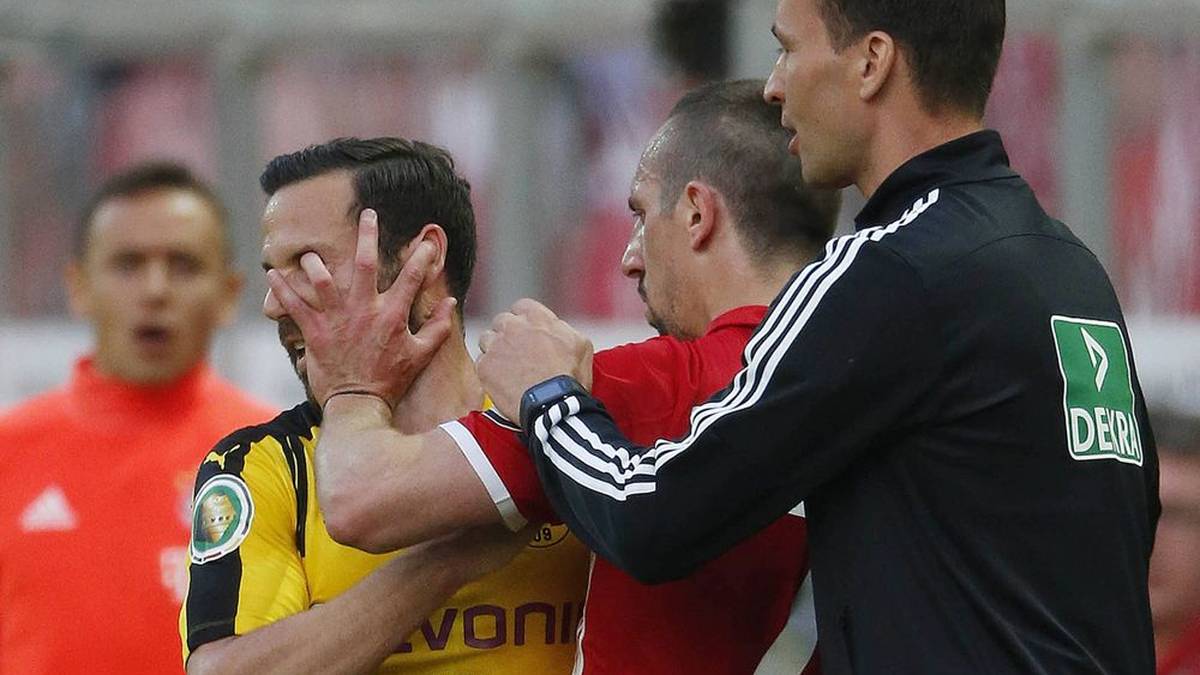 Beim DFB-Pokalfinale zwischen Borussia Dortmund und dem FC Bayern München 2016 landete der Finger von Ribéry im Auge von Castro