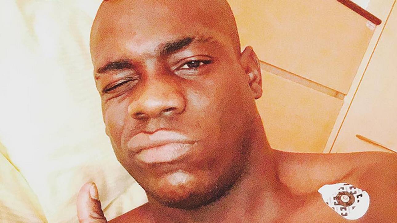 Balotelli in München operiert