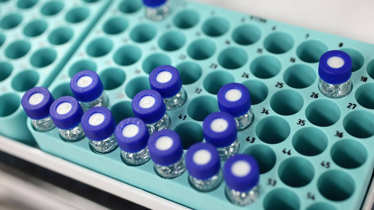 Uni bestätigt Singlers Rücktritt