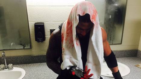 Eine Prügelei mit Gegner Triple H löste bei WWE-Star Roman Reigns Blutströme aus