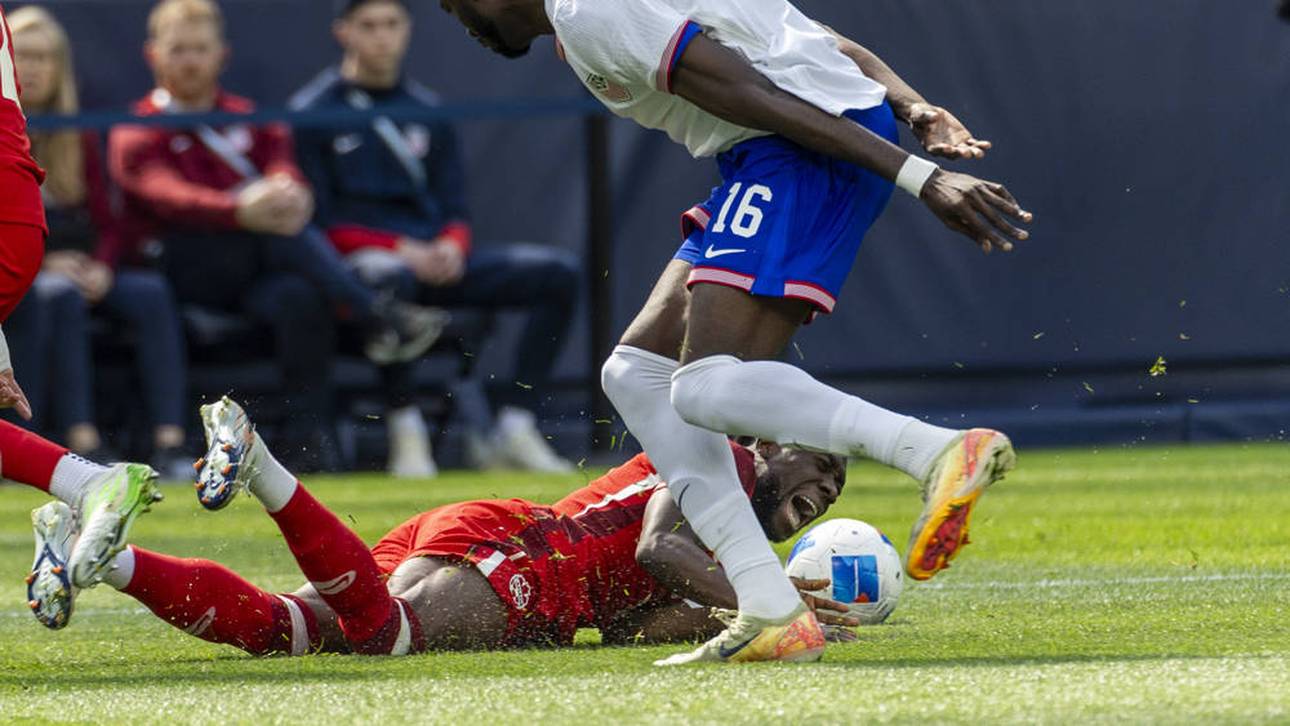 Bayern-Star Davies verletzt