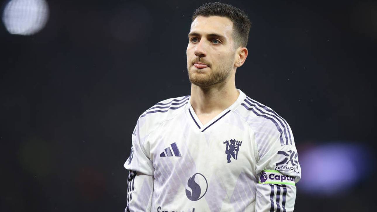 Heftige Kritik an United-Duo