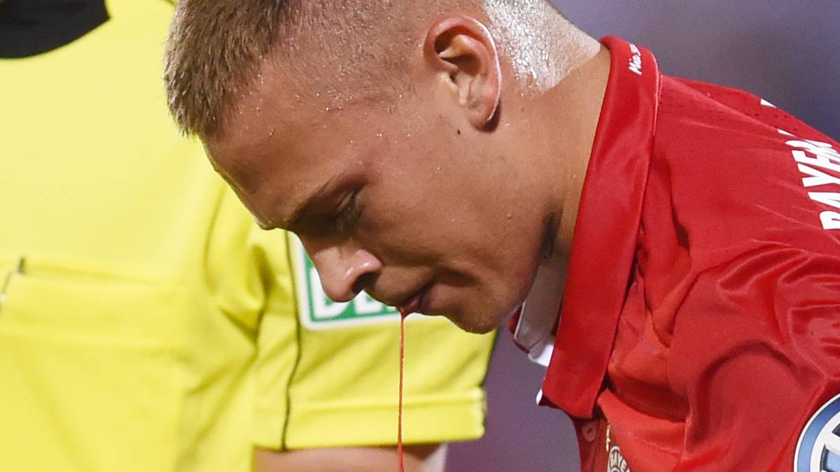 ...befürchtet, dass ihm ein Zahn ausgeschlagen wurde und spuckt Blut. Wie es scheint, ist der Zahn aber heile geblieben 