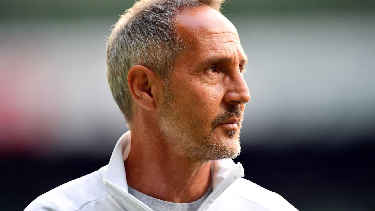 Hütter: Pokal-Aus gut wegzustecken