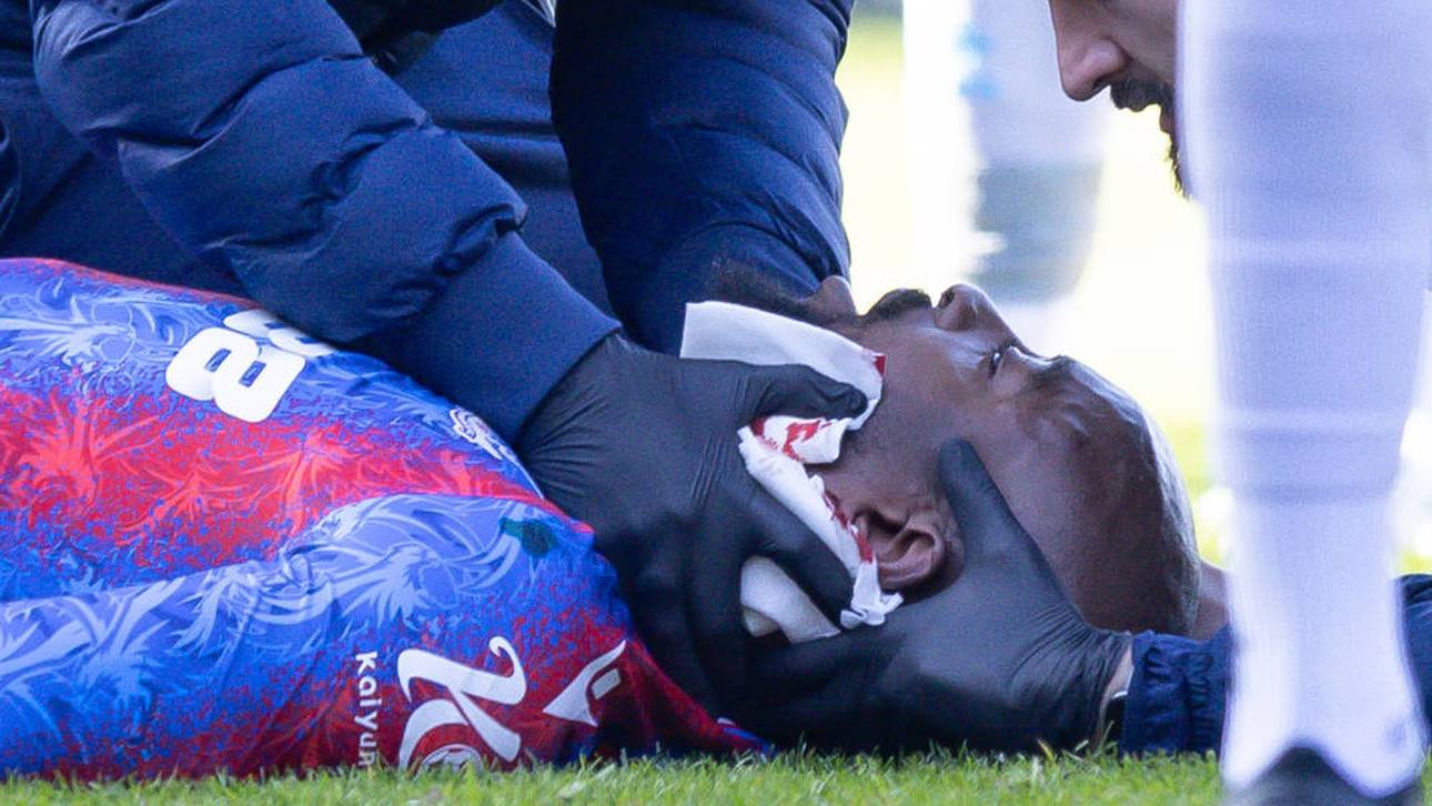 Ohr zerfetzt: Mateta schildert Horror