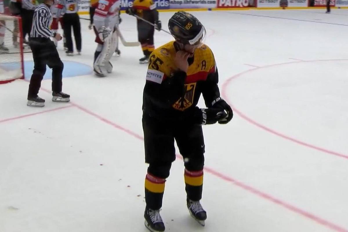 Das deutsche Aus bei der Eishockey-WM ist für Marc Michaelis ein ganz besonders schmerzhaftes: Nachdem er gegen Dänemark den Puck ins Gesicht bekommt, stellt sich seine Verletzung als Kieferbruch heraus.