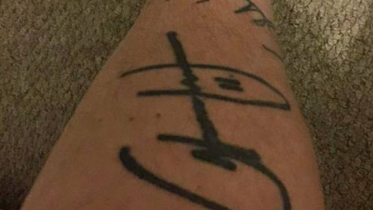 ManCity-Fan will Tattoo loswerden