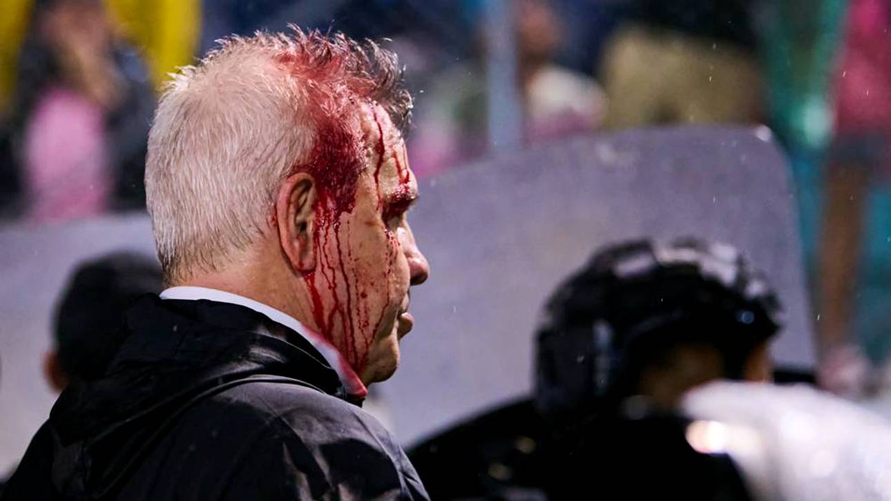 Trainer übel verletzt – Reaktion verwundert