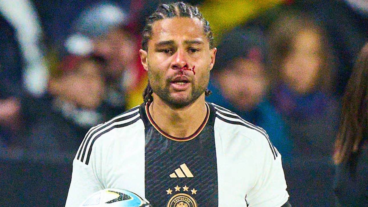 DFB-Star kassiert blutige Nase