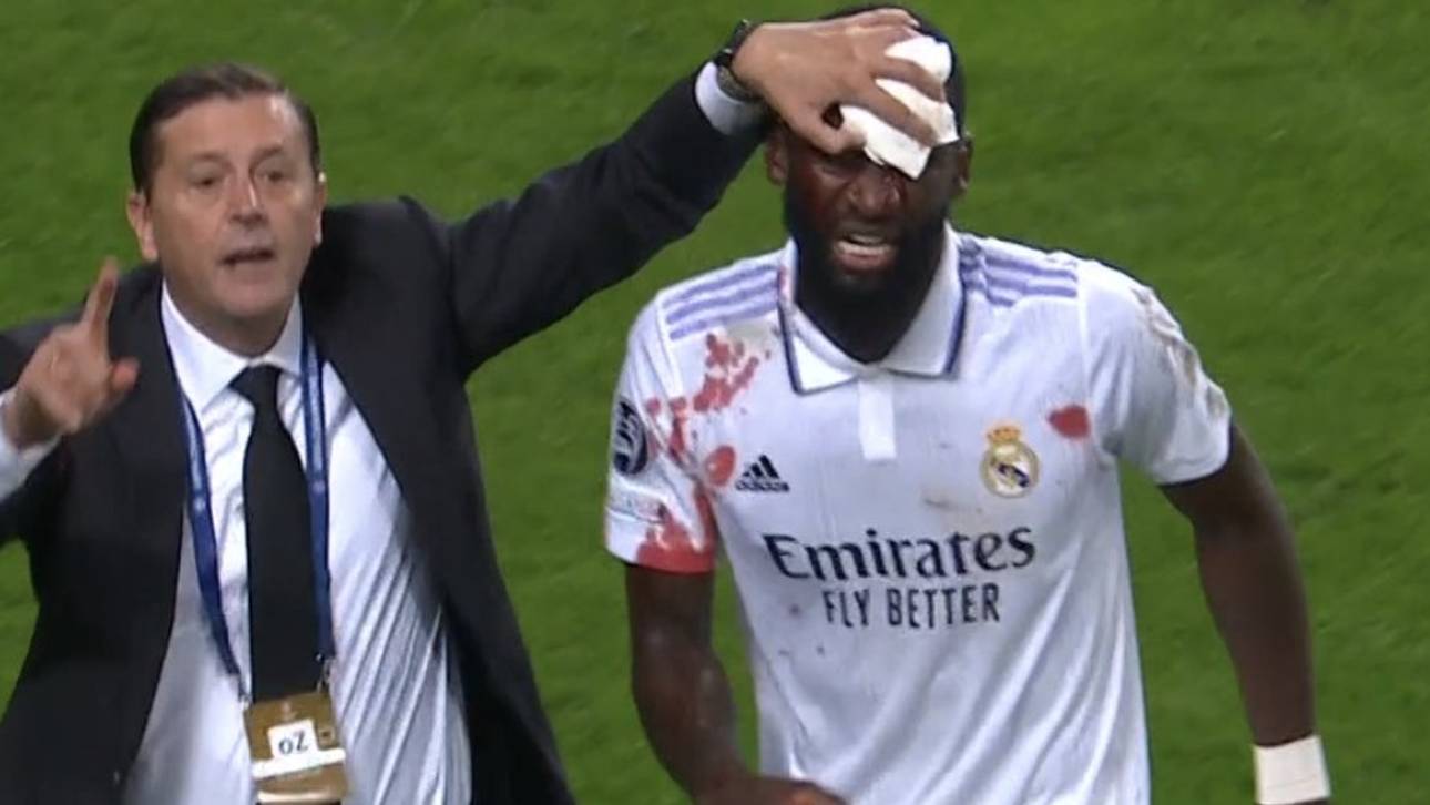 20 Stiche! Rüdigers blutige Heldentat