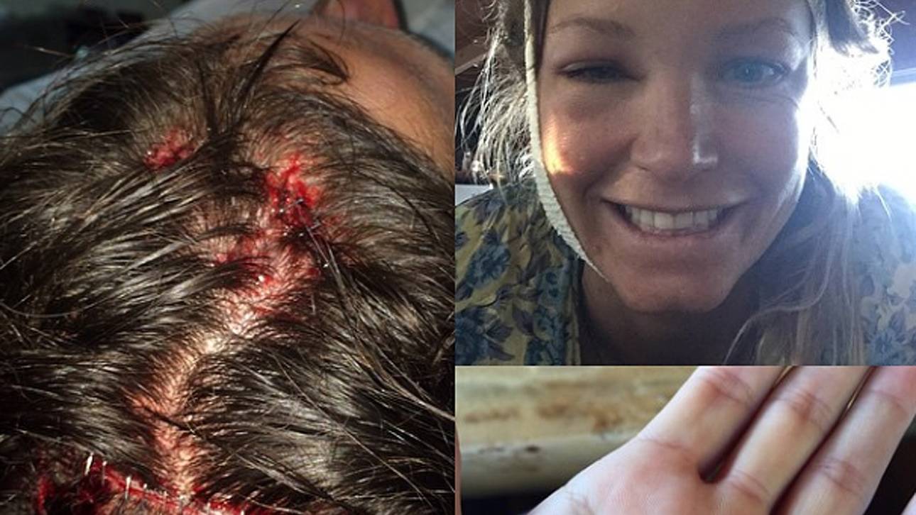 Julia Mancuso-verletzt beim Surfen