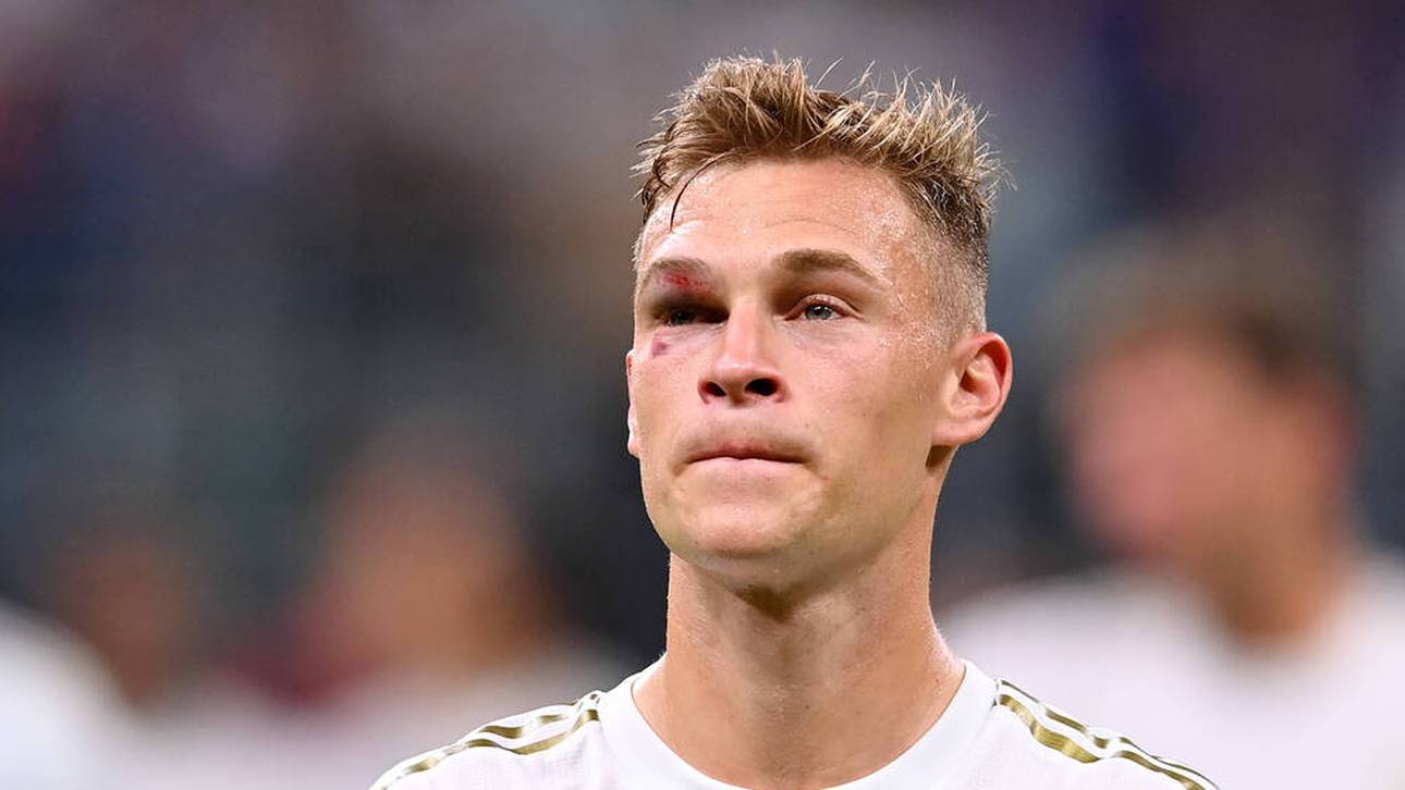 Blaues Auge! So geht es Kimmich