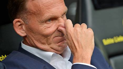BVB-Boss Hans-Joachim Watzke kann die Kaderauswahl von Joachim Löw nicht verstehen 