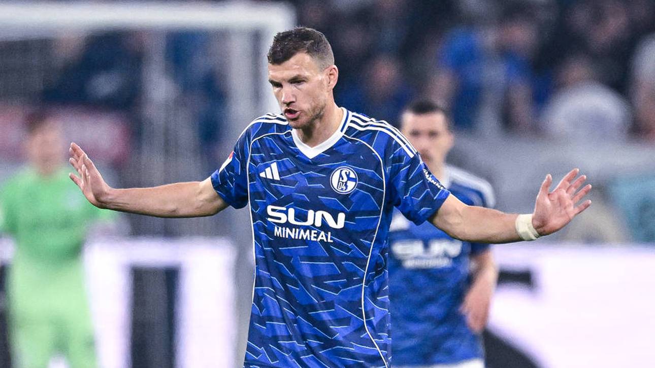 Dzeko leidet bei Schalke-Sieg