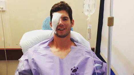 Matt Imhof verlor nach einem Missgeschick sein rechtes Auge