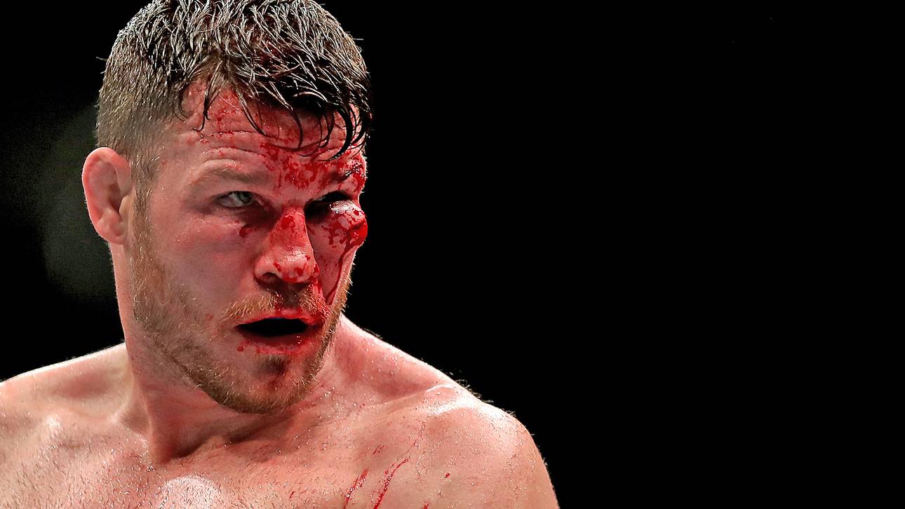 Bisping bezahlt UFC-Rekordsieg blutig