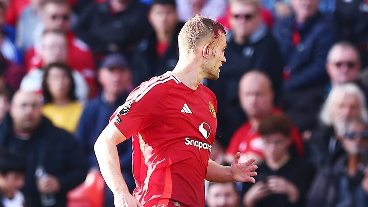 Auf Grund einer Kopfverletzung fehlte Matthijs de Ligt beim Gegentreffer